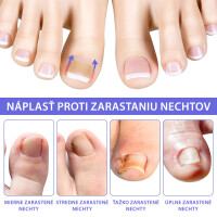 naplasti-nehty-1_2.jpg
